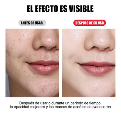 Máscara LED de Fototerapia 7 Colores Rejuvenecedora